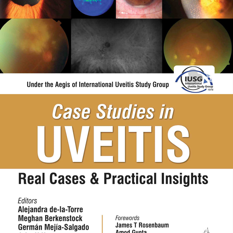 CASE STUDIES IN UVEITIS : REAL CASES AND PRACTICAL INSIGHTS, 1/E, BY, ALEJANDRA DE-LA-TORRE