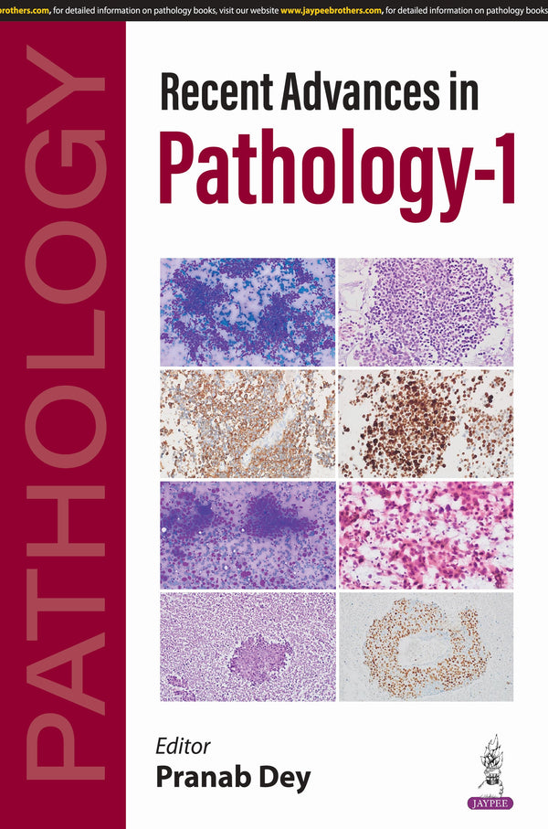 PRANAB DEY
, RECENT ADVANCES IN PATHOLOGY-1, 1/E, 9789366160986