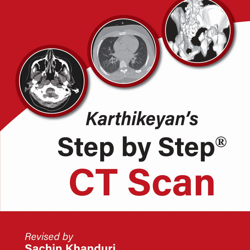 KARTHIKEYAN'S STEP BY STEP CT SCAN, 2/E R.P., BY, SACHIN KHANDURI