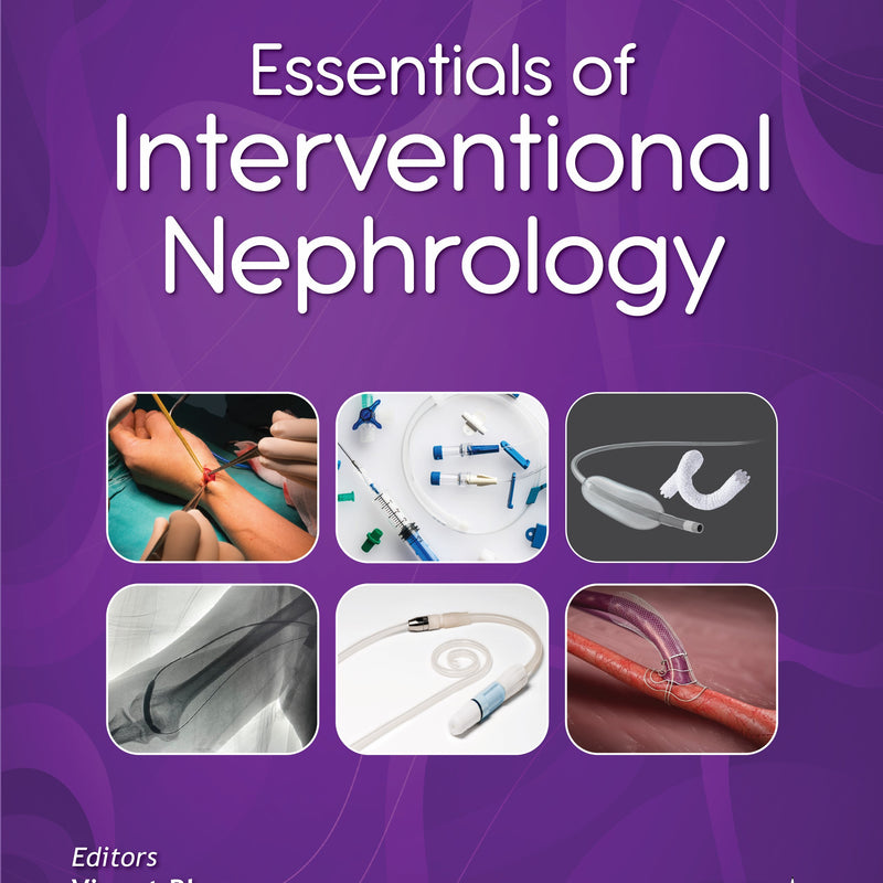 ESSENTIALS OF INTERVENTIONAL NEPHROLOGY, 1/E, BY, VINANT BHARGAVA