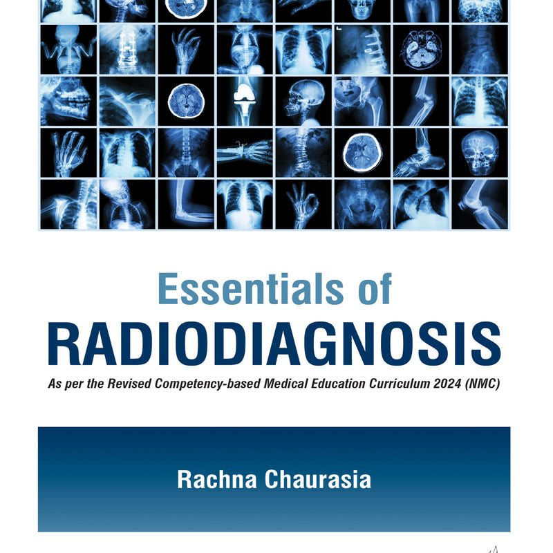 ESSENTIALS OF RADIODIAGNOSIS 1/E, 2025, RACHNA CHAURASIA