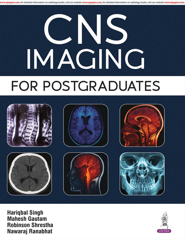 CNS IMAGING FOR POSTGRADUATES, 1/E, HARIQBAL SINGH