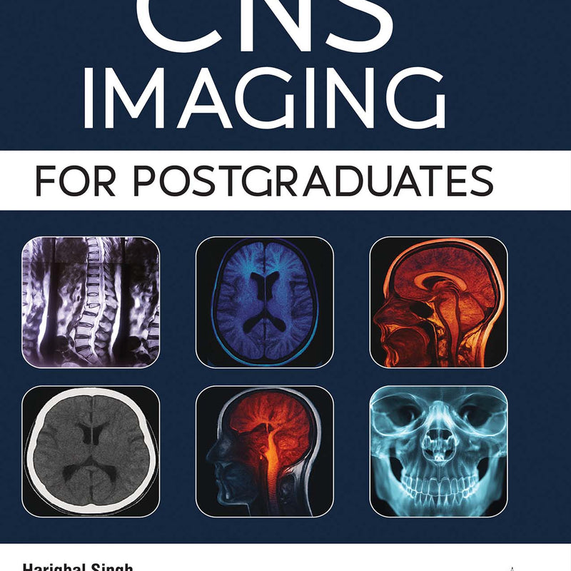 CNS IMAGING FOR POSTGRADUATES, 1/E, HARIQBAL SINGH