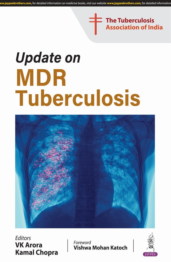 UPDATE ON MDR TUBERCULOSIS, 1/E, BY, VK ARORA