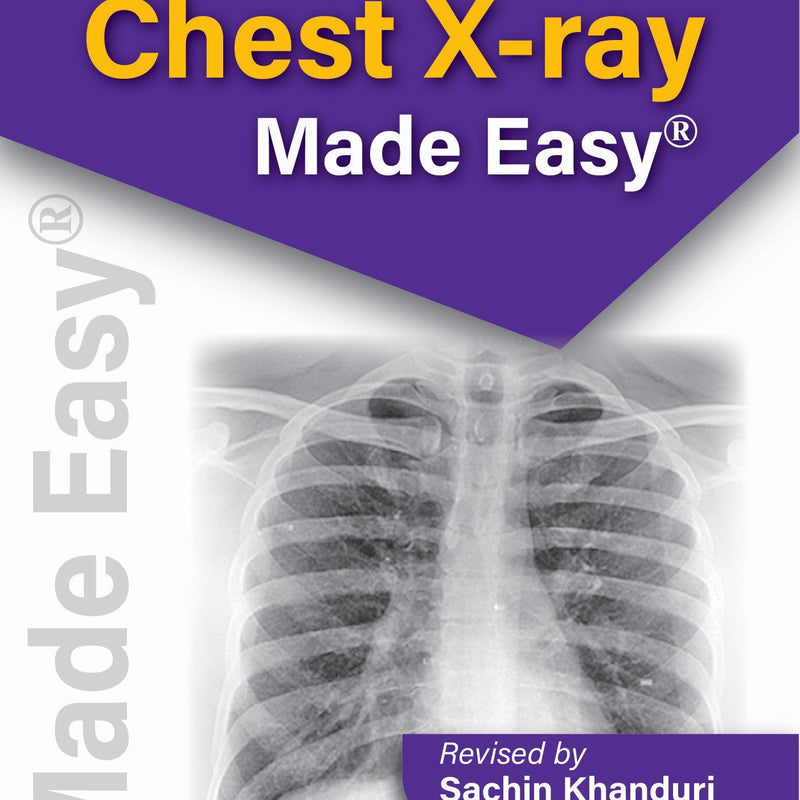 KARTHIKEYAN'S CHEST X-RAY MADE EASY, 3/E R.P., BY, SACHIN KHANDURI