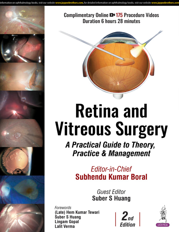 RETINA AND VITREOUS SURGERY : A PRACTICAL GUIDE TO THEORY, PRACTICE & MANAGEMENT, 2/E R.P., BY, SUBHENDU KUMAR BORAL