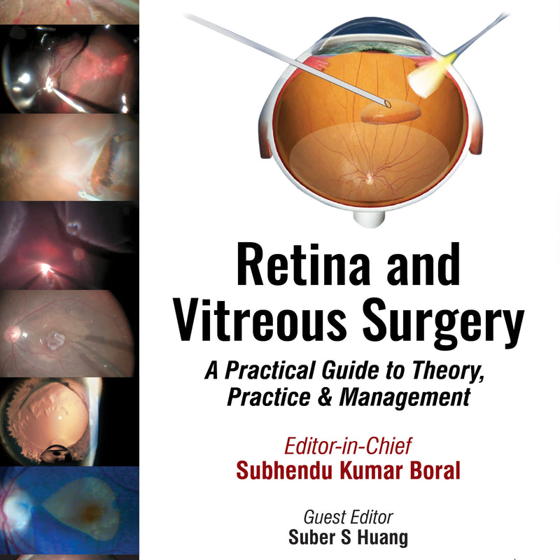 RETINA AND VITREOUS SURGERY : A PRACTICAL GUIDE TO THEORY, PRACTICE & MANAGEMENT, 2/E R.P., BY, SUBHENDU KUMAR BORAL