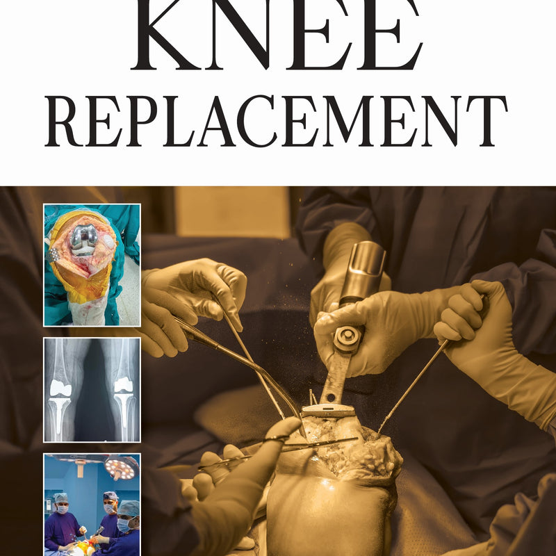 KNEE REPLACEMENT, 3/E, BY, SKS MARYA