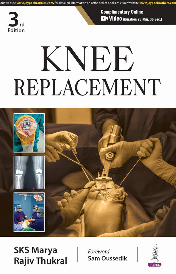 KNEE REPLACEMENT, 3/E, BY, SKS MARYA