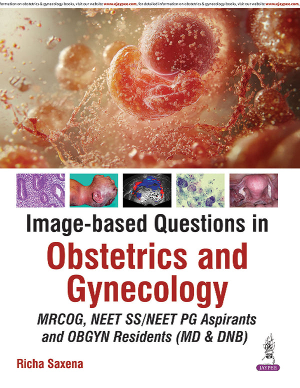 Image-Based Questions in Obstetrics and Gynecology - RICHA SAXENA (Pre-Order)