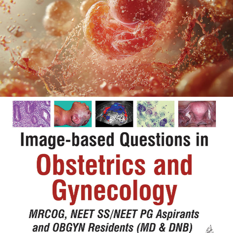 Image-Based Questions in Obstetrics and Gynecology - RICHA SAXENA (Pre-Order)