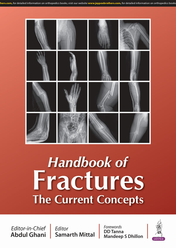 HANDBOOK OF FRACTURES THE CURRENT CONCEPTS, 1/E, BY, ABDUL GHANI