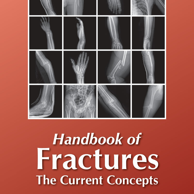 HANDBOOK OF FRACTURES THE CURRENT CONCEPTS, 1/E, BY, ABDUL GHANI