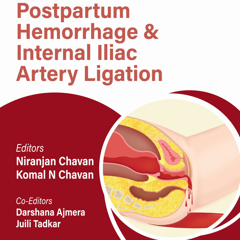 OBS AND GYNAE PG FOCUS SERIES POSTPARTUM HEMORRHAGE & INTERNAL ILIAC ARTERY LIGATION 1/E, 2025, NIRANJAN CHAVAN