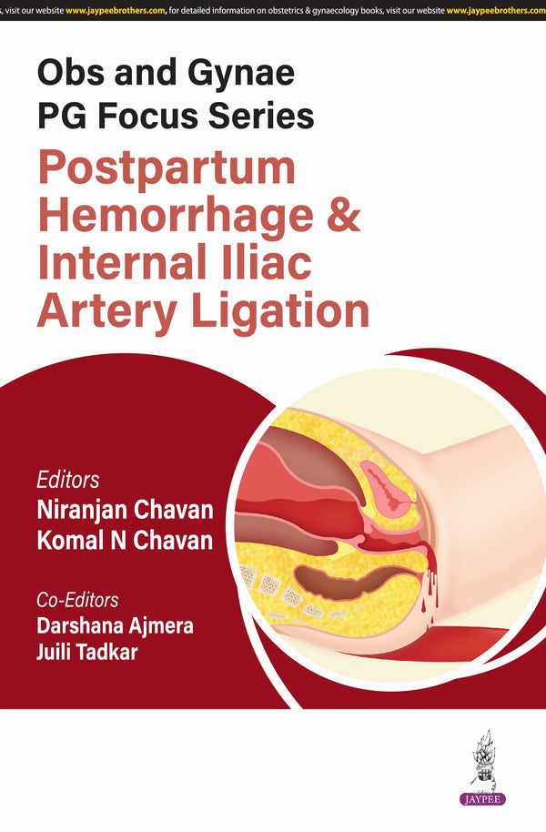 OBS AND GYNAE PG FOCUS SERIES POSTPARTUM HEMORRHAGE & INTERNAL ILIAC ARTERY LIGATION 1/E, 2025, NIRANJAN CHAVAN