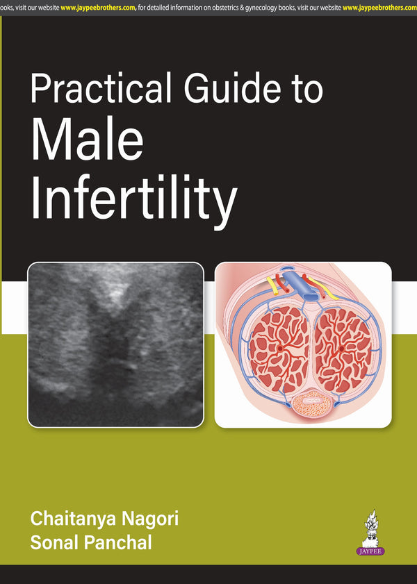 PRACTICAL GUIDE TO MALE INFERTILITY, 1/E R.P., BY, CHAITANYA NAGORI