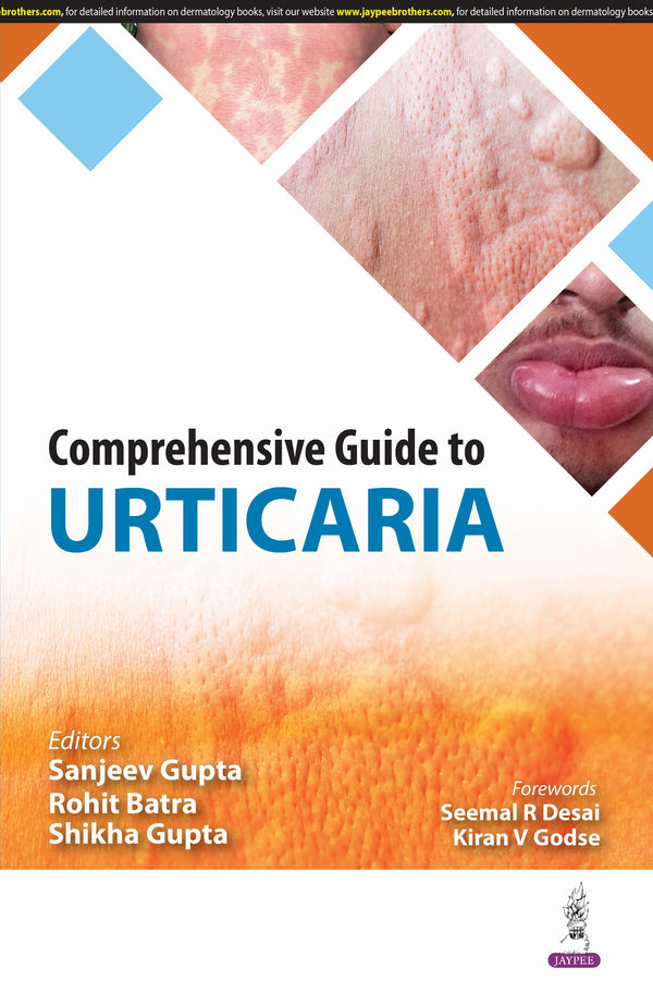 COMPREHENSIVE GUIDE TO URTICARIA 1/E, 2025, SANJEEV GUPTA