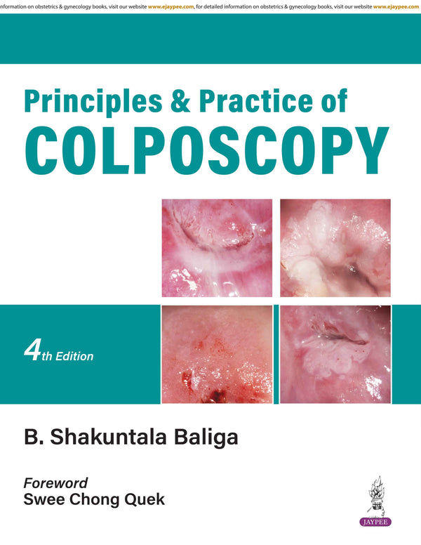 PRINCIPLES AND PRACTICE OF COLPOSCOPY, 4/E, B SHAKUNTALA BALIGA