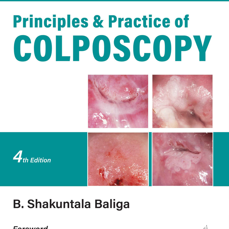 PRINCIPLES AND PRACTICE OF COLPOSCOPY, 4/E, B SHAKUNTALA BALIGA