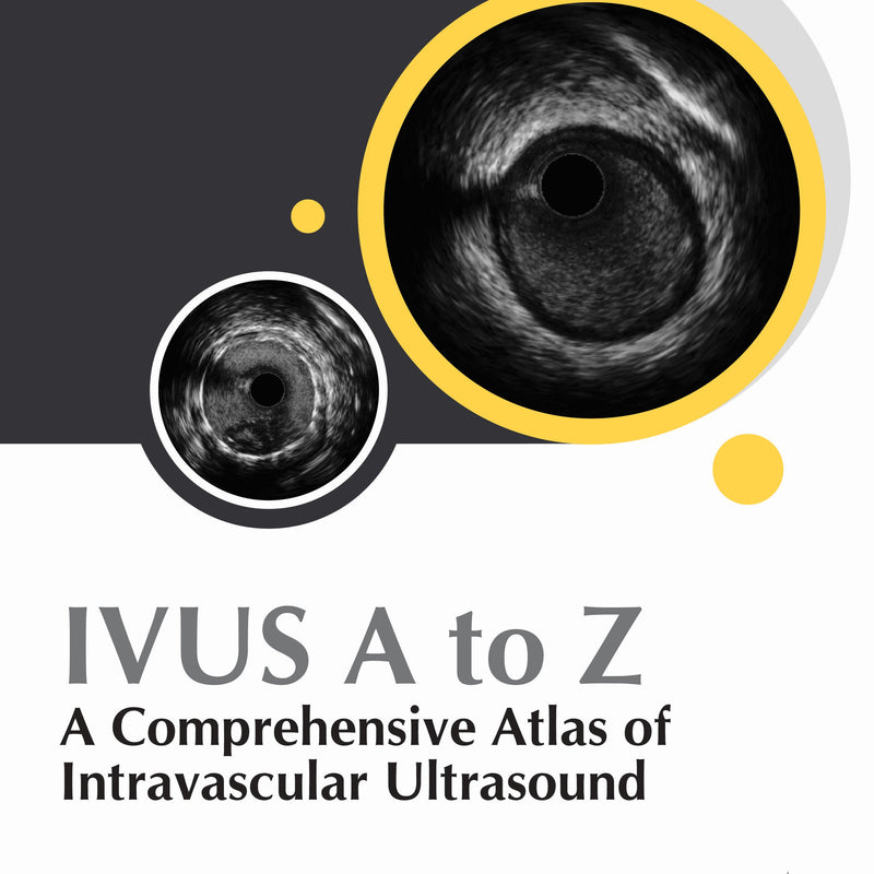 IVUS A TO Z : A COMPREHENSIVE ATLAS OF INTRAVASCULAR ULTRASOUND 1/E, 2025, PANKAJ MANORIA