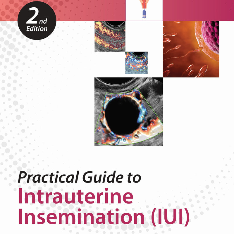 PRACTICAL GUIDE TO INTRAUTERINE INSEMINATION (IUI) 2/E, 2025, CHAITANYA NAGORI