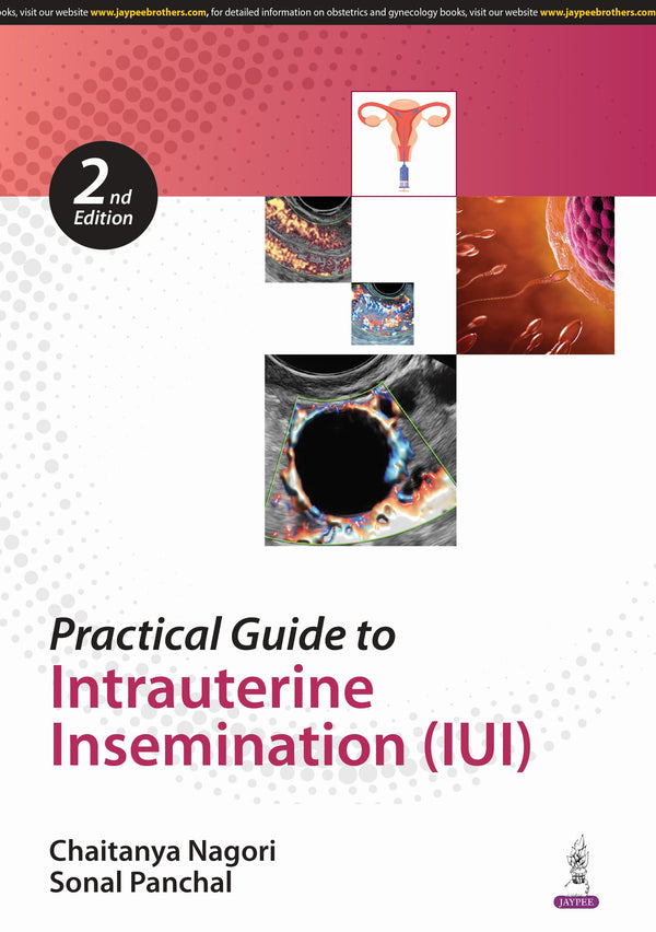 PRACTICAL GUIDE TO INTRAUTERINE INSEMINATION (IUI) 2/E, 2025, CHAITANYA NAGORI