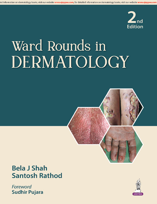 WARD ROUNDS IN DERMATOLOGY, 2/E, BELA J SHAH