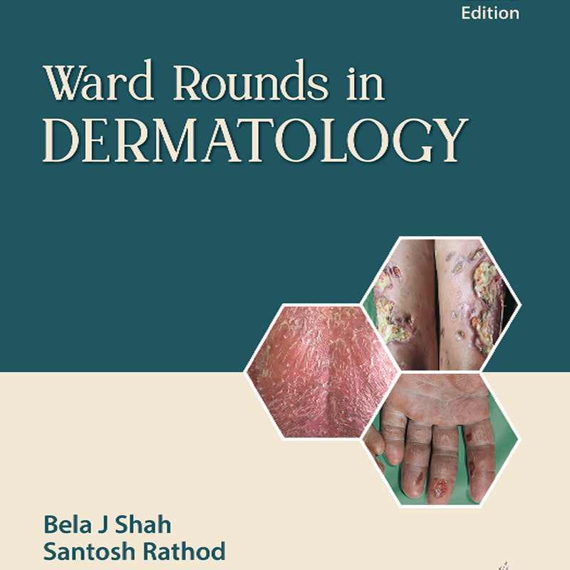 WARD ROUNDS IN DERMATOLOGY, 2/E, BELA J SHAH