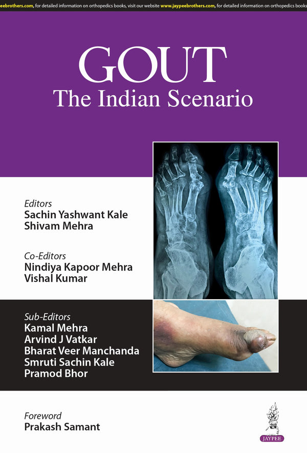 GOUT THE INDIAN SCENARIO, 1/E R.P., BY, SACHIN YASHWANT KALE