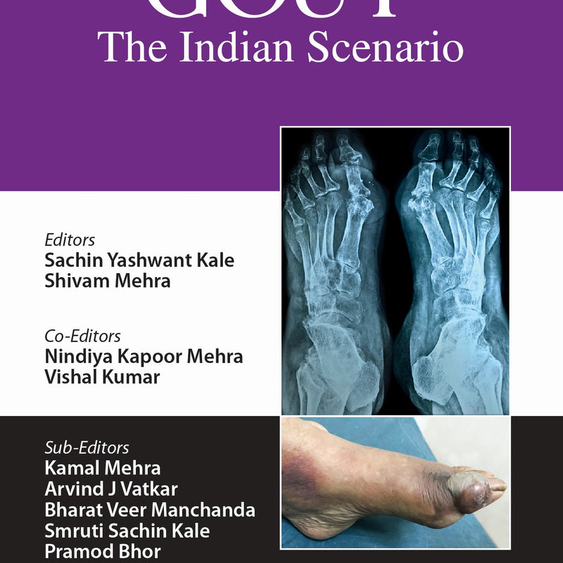 GOUT THE INDIAN SCENARIO, 1/E R.P., BY, SACHIN YASHWANT KALE