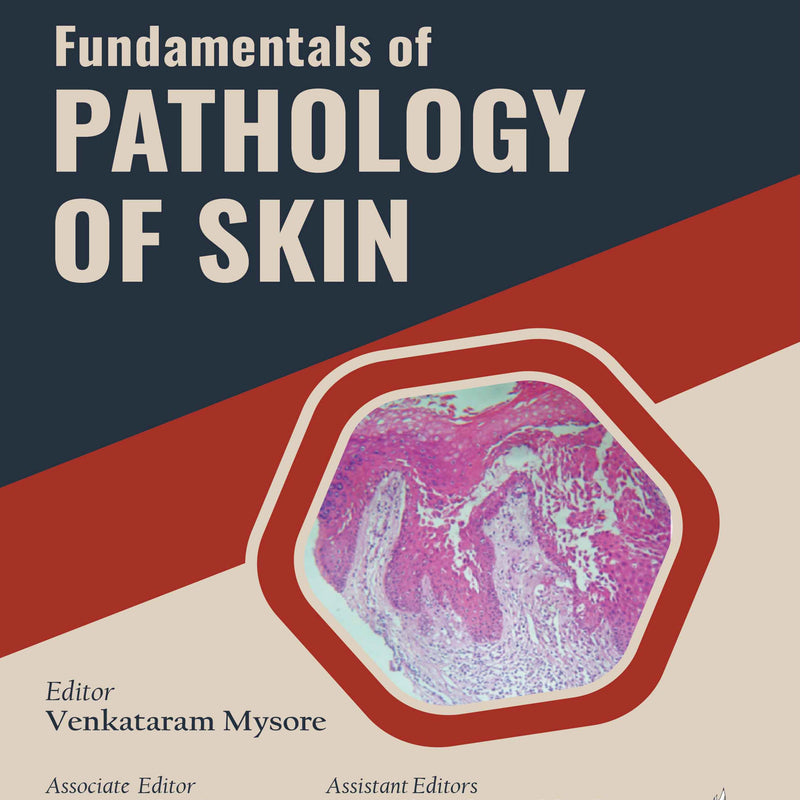 FUNDAMENTALS OF PATHOLOGY OF SKIN, 6/E, BY, VENKATARAM MYSORE