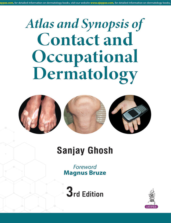 ATLAS AND SYNOPSIS OF CONTACT AND OCCUPATIONAL DERMATOLOGY, 3/E, SANJAY GHOSH