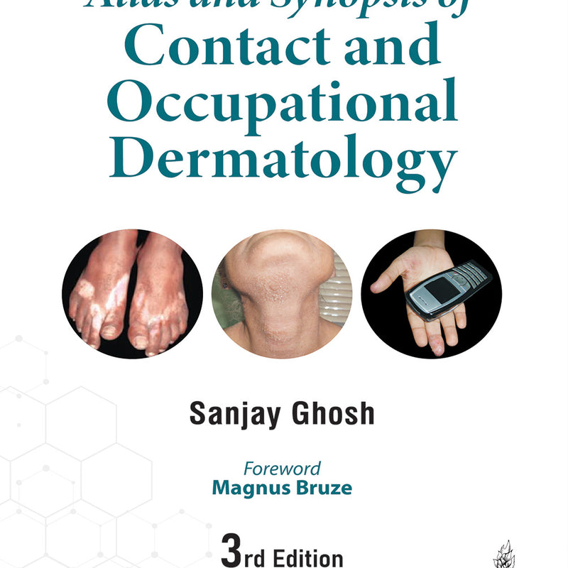 ATLAS AND SYNOPSIS OF CONTACT AND OCCUPATIONAL DERMATOLOGY, 3/E, SANJAY GHOSH