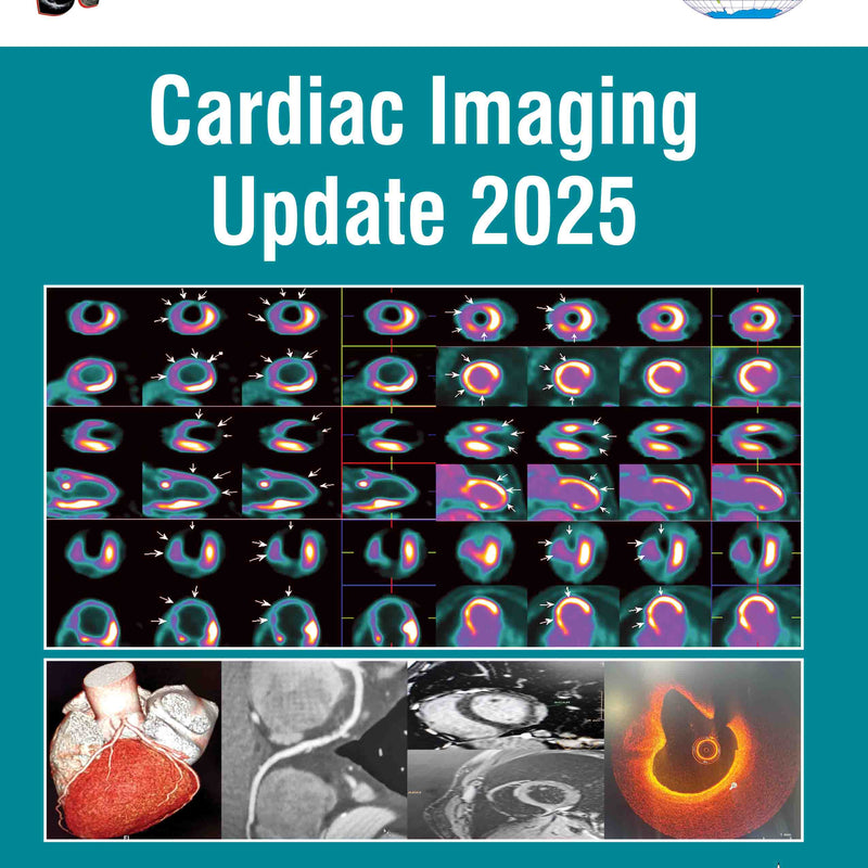 CARDIAC IMAGING UPDATE 2025, 1/E, BY, GN MAHAPATRA