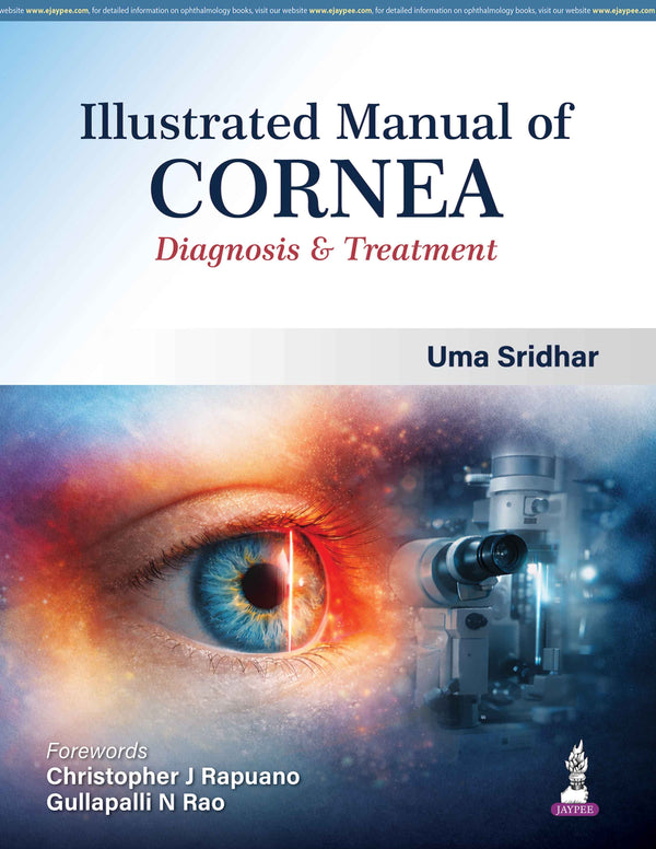 ILLUSTRATED MANUAL OF CORNEA DIAGNOSIS & TREATMENT, 1/E, BY, UMA SRIDHAR