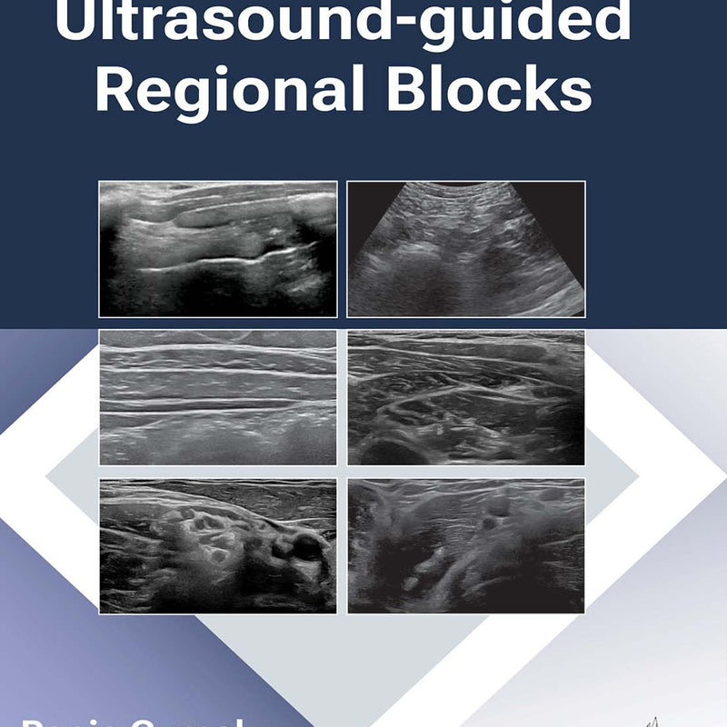 ULTRASOUND-GUIDED REGIONAL BLOCKS, 1/E, POOJA GURNAL
