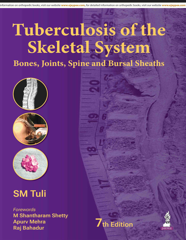 TUBERCULOSIS OF THE SKELETAL SYSTEM, 7/E, BY, SM TULI