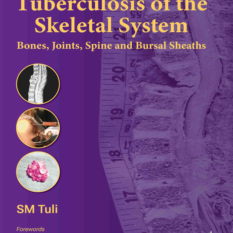 TUBERCULOSIS OF THE SKELETAL SYSTEM, 7/E, BY, SM TULI