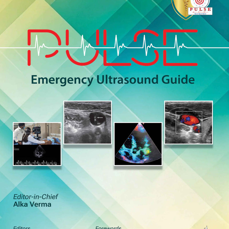 PULSE: EMERGENCY ULTRASOUND GUIDE, 1/E, ALKA VERMA