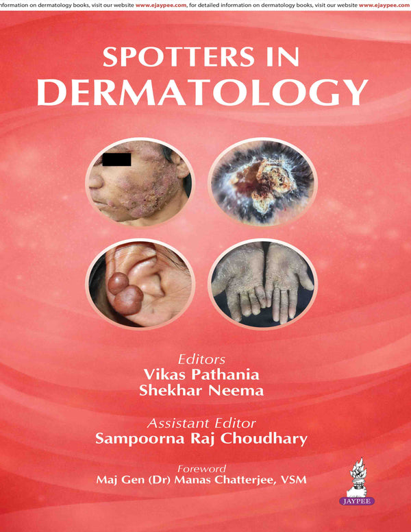 SPOTTERS IN DERMATOLOGY, 1/E, BY, VIKAS PATHANIA