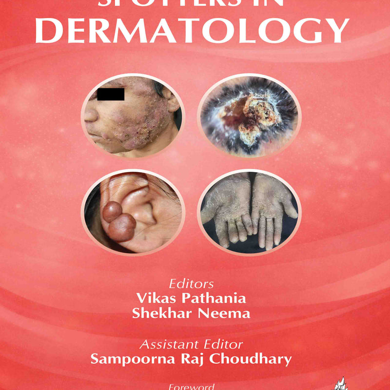 SPOTTERS IN DERMATOLOGY, 1/E, BY, VIKAS PATHANIA