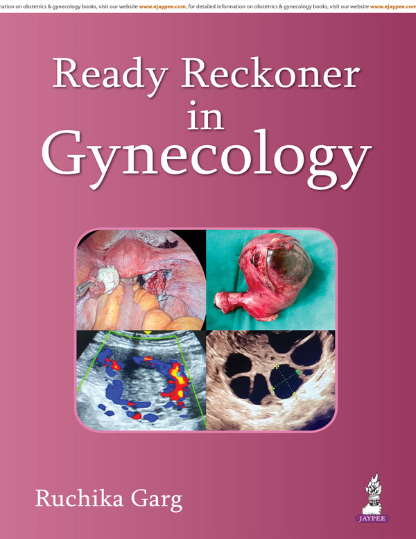 READY RECKONER IN GYNECOLOGY, 1/E, BY, RUCHIKA GARG