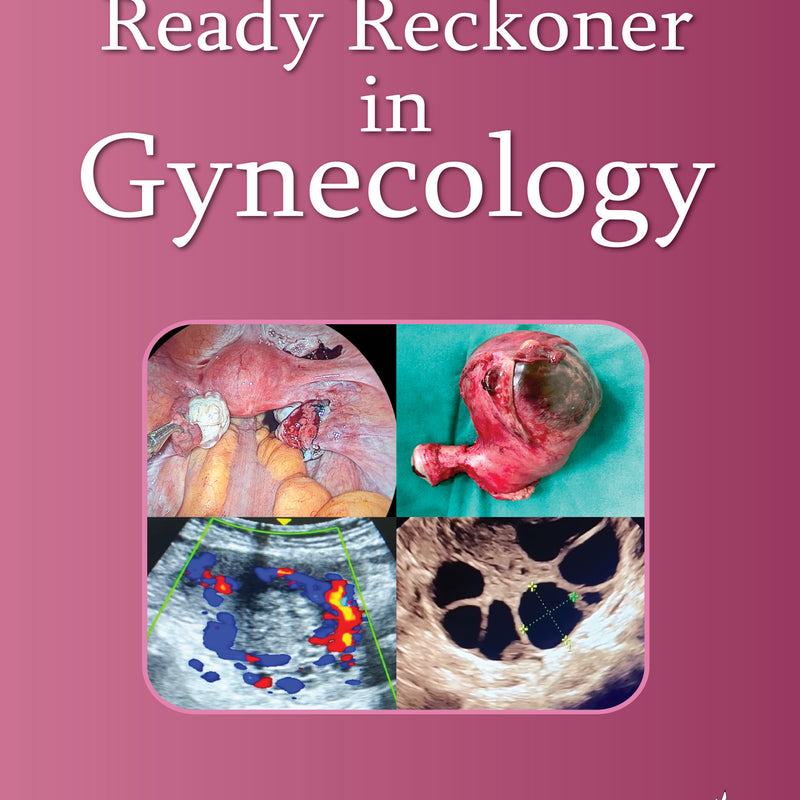READY RECKONER IN GYNECOLOGY, 1/E, BY, RUCHIKA GARG