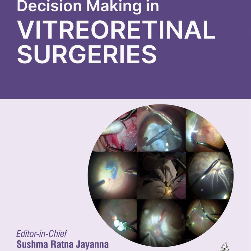 DECISION MAKING IN VITREORETINAL SURGERIES, 1/E, BY, SUSHMA RATNA JAYANNA