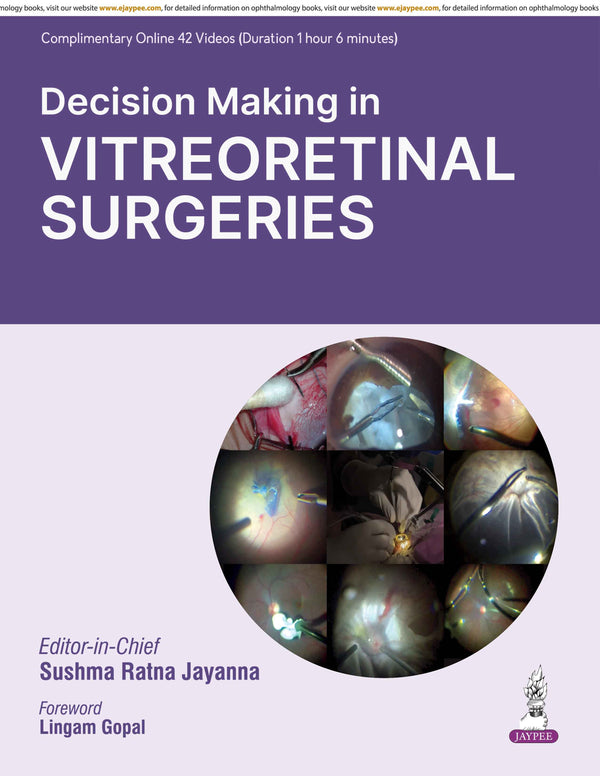 DECISION MAKING IN VITREORETINAL SURGERIES, 1/E, BY, SUSHMA RATNA JAYANNA