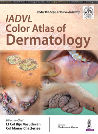 IADVL COLOR ATLAS OF DERMATOLOGY 1/E, 2016, BIJU VASUDEVAN