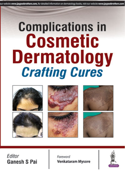 COMPLICATIONS IN COSMETIC DERMATOLOGY - CRAFTING CURES 1/E, 2016, GANESH S PAI