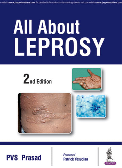 ALL ABOUT LEPROSY, 2/E R.P., BY, PRASAD PVS