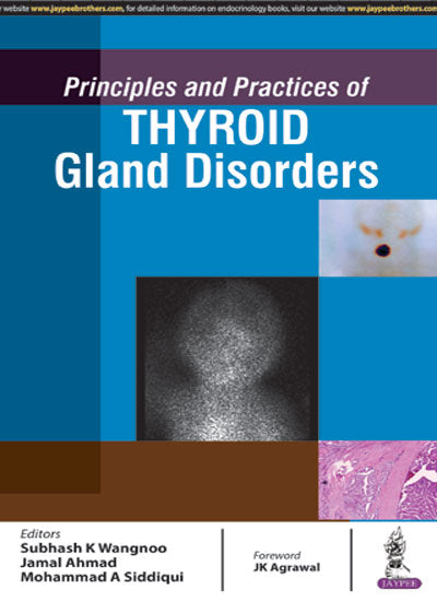 PRINCIPLES AND PRACTICES OF THYROID GLAND DISORDERS, 1/E, BY, SUBHASH K WANGNOO