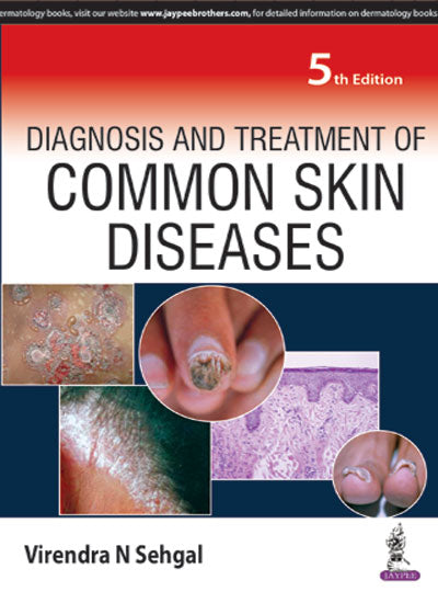 DIAGNOSIS AND TREATMENT OF COMMON SKIN DISEASES, 5/E R.P., BY, VIRENDRA N SEHGAL